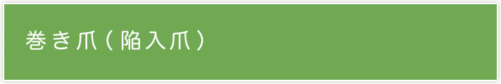 巻き爪(陥入爪)